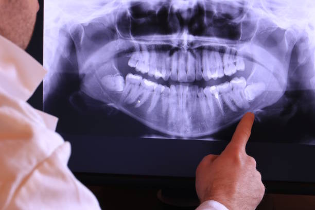 Best Emergency Denture Repair in Maricopa, AZ